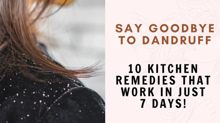natural dandruff remedies