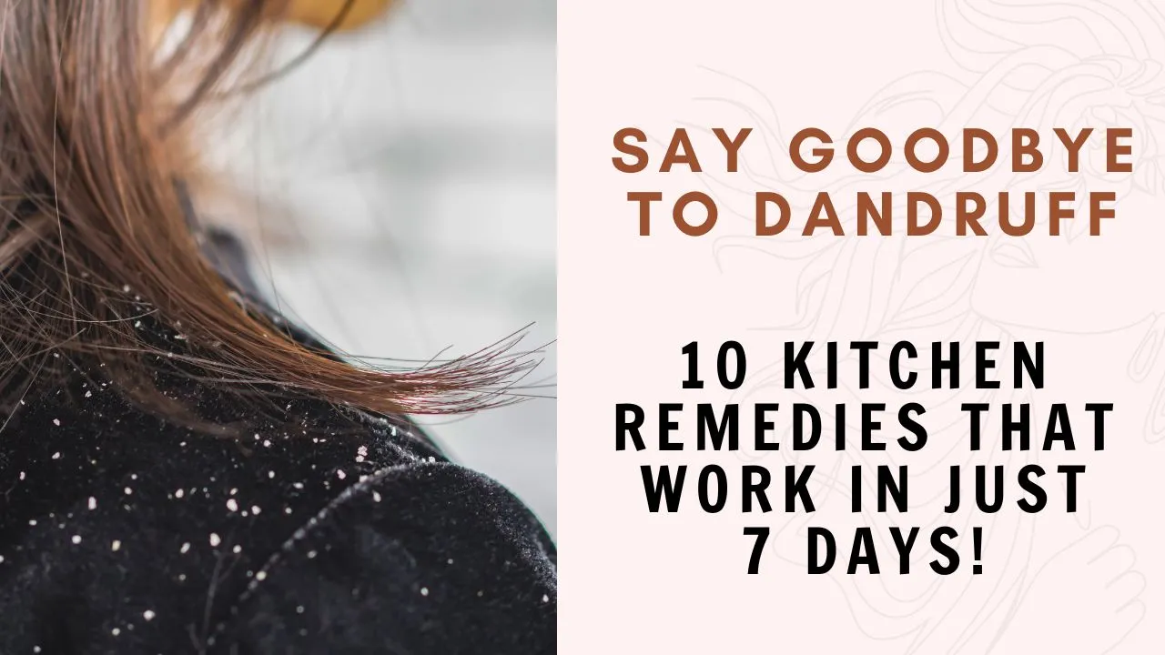 natural dandruff remedies